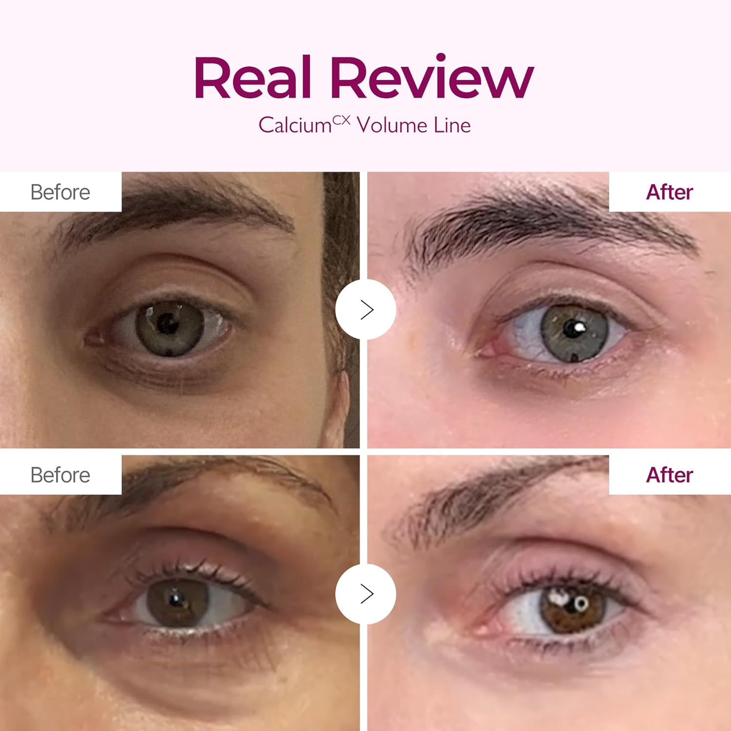 Dr.Melaxin - Cemenrete Calcium Volume Cream 50ml