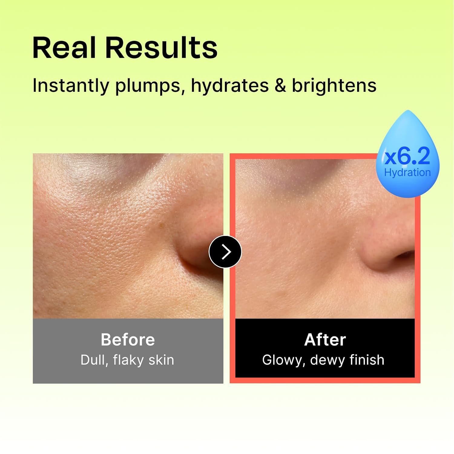 Celladix - Hyaluronic Intense Serum 50ml