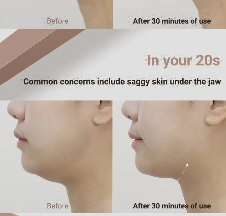 MARSHIQUE - Line Lifting Hydrogel Jawline Patch