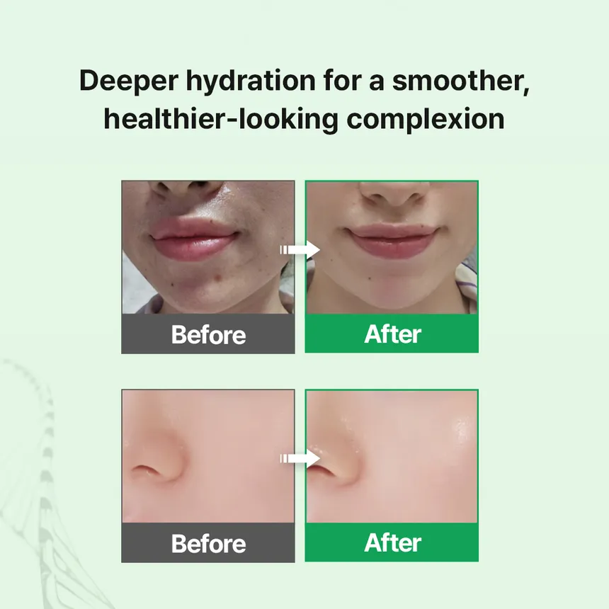 zipiderm - EGF Skin Barrier Hydro Ampoule 30ml