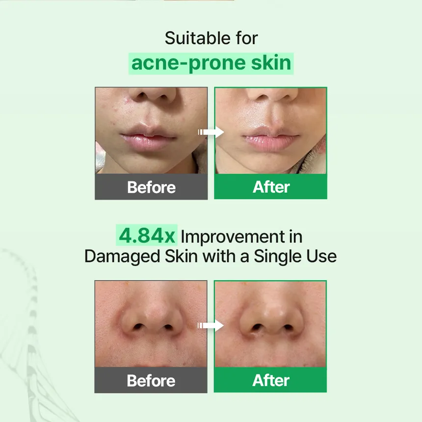 zipiderm - EGF Skin Barrier Cream Toner 150ml