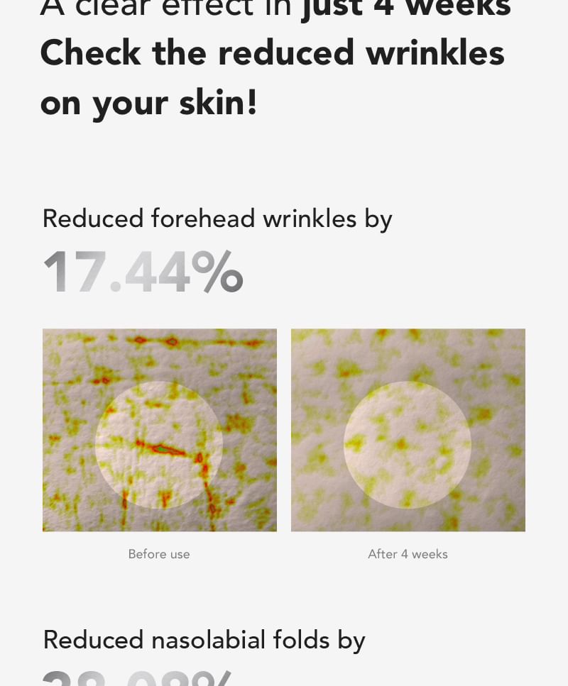 SKIN&LAB - Retinol Lifting Roller Cream 50ml