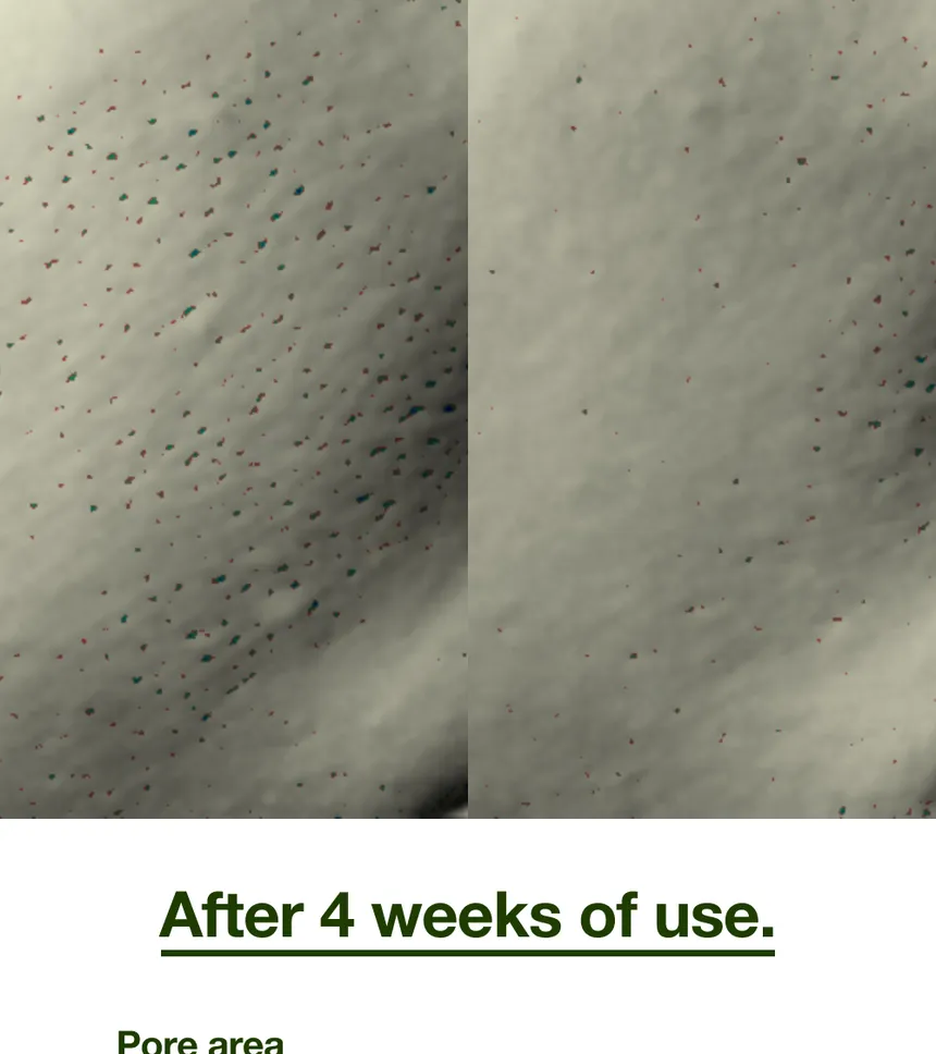 ODELOI - Low pH Pore Tightening Nid Soap 120g